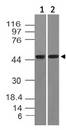 TRDMT1 / DNMT2 Antibody - Fig-1: Western blot analysis of DNMT2. Anti-DNMTc2 antibody was used at 4 µg/ml on Jurkat and mouse embryonic liver lysates.