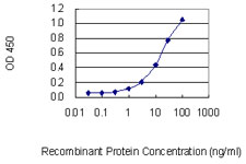 Treacle / TCOF1 Antibody - Detection limit for recombinant GST tagged TCOF1 is 0.3 ng/ml as a capture antibody.