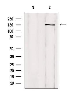 Treacle / TCOF1 Antibody - Western blot analysis of extracts of mouse brain tissue using TCOF1 antibody. Lane 1 was treated with the blocking peptide.