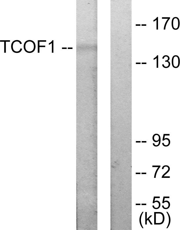 Treacle / TCOF1 Antibody - Western blot analysis of extracts from Jurkat cells, using TCOF1 antibody.