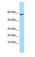 TREH Antibody - TREH antibody Western Blot of HeLa.  This image was taken for the unconjugated form of this product. Other forms have not been tested.