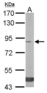 TREH Antibody - Sample (50 ug of whole cell lysate). A: mouse stomach. 7.5% SDS PAGE. TREH antibody diluted at 1:3000.