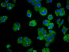TREH Antibody - Immunofluorescence staining of HepG2 cells diluted at 1:66, counter-stained with DAPI. The cells were fixed in 4% formaldehyde, permeabilized using 0.2% Triton X-100 and blocked in 10% normal Goat Serum. The cells were then incubated with the antibody overnight at 4°C.The Secondary antibody was Alexa Fluor 488-congugated AffiniPure Goat Anti-Rabbit IgG (H+L).