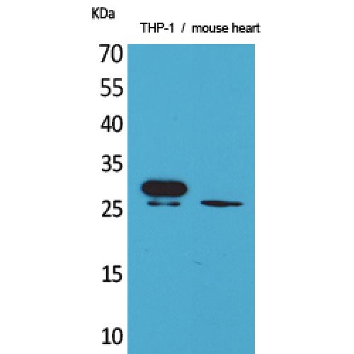 TREM1 Antibody - Western blot of TREM-1 antibody