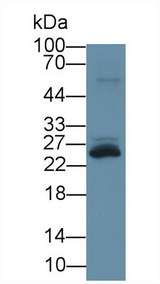 TREM1 Antibody - Western Blot; Sample: Rat Spleen lysate; ;Primary Ab: 3µg/ml Rabbit Anti-Human TREM1 Antibody;Second Ab: 0.2µg/mL HRP-Linked Caprine Anti-Rabbit IgG Polyclonal Antibody;