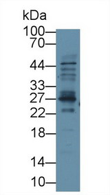 TREM1 Antibody - Western Blot; Sample: Human Placenta lysate; ;Primary Ab: 3µg/ml Rabbit Anti-Human TREM1 Antibody;Second Ab: 0.2µg/mL HRP-Linked Caprine Anti-Rabbit IgG Polyclonal Antibody;(Catalog: SAA544Rb19