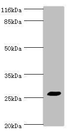 TREM1 Antibody - Western blot All lanes: TREM1 antibody at 2µg/ml + HepG2 whole cell lysate Secondary Goat polyclonal to rabbit IgG at 1/10000 dilution Predicted band size: 27, 18, 26 kDa Observed band size: 27 kDa
