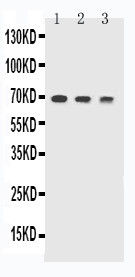 TREM1 Antibody - WB of TREM1 / TREM-1 antibody. All lanes: Anti-TREM1 at 0.5ug/ml. Lane 1: Recombinant Mouse TREM1 Protein 10ng. Lane 2: Recombinant Mouse TREM1 Protein 5ng. Lane 3: Recombinant Mouse TREM1 Protein 2.5ng. Predicted bind size: 47KD. Observed bind size: 70KD.