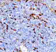 TREM1 Antibody - Anti-TREM1 antibody, IHC(P): Mouse Spleen Tissue