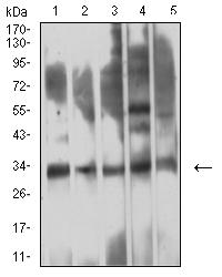 TREM1 Antibody - Western blot analysis using CD354 mouse mAb against HepG2 (1), COS7 (2), A549 (3), SPC-A-1 (4), and C6 (5) cell lysate.
