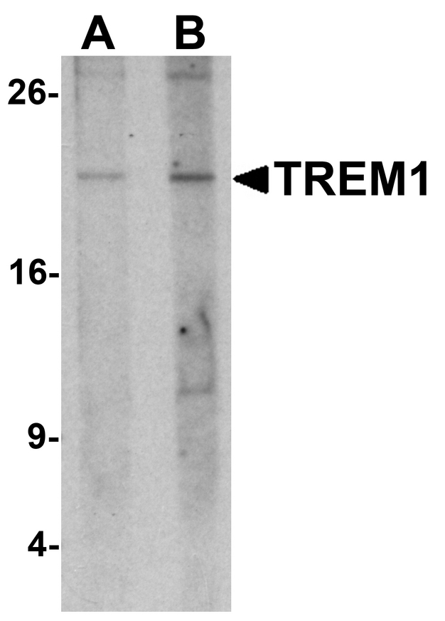 TREM1 Antibody - Western blot analysis of TREM1 in 293 cell lysate with TREM1 antibody at (A) 1 and (B) 2 ug/ml.