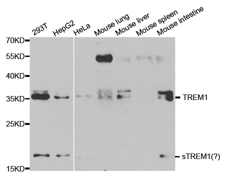 TREM1 Antibody - Western blot analysis of extracts of various cell lines, using TREM1 antibody at 1:1000 dilution. The secondary antibody used was an HRP Goat Anti-Rabbit IgG (H+L) at 1:10000 dilution. Lysates were loaded 25ug per lane and 3% nonfat dry milk in TBST was used for blocking.