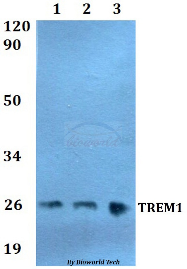 TREM1 Antibody - Western blot of TREM1 antibody at 1:500 dilution. Lane 1: HEK293T whole cell lysate. Lane 2: sp2/0 whole cell lysate. Lane 3: PC12 whole cell lysate.