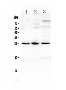 TREM1 Antibody - Western blot - Anti-TREM1 Picoband Antibody