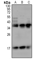 TREM1 Antibody - Western blot analysis of CD354 expression in U87MG (A), A549 (B), LO2 (C) whole cell lysates.