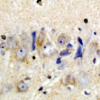 TREM1 Antibody - Immunohistochemical analysis of CD354 staining in human brain formalin fixed paraffin embedded tissue section. The section was pre-treated using heat mediated antigen retrieval with sodium citrate buffer (pH 6.0). The section was then incubated with the antibody at room temperature and detected using an HRP conjugated compact polymer system. DAB was used as the chromogen. The section was then counterstained with haematoxylin and mounted with DPX.