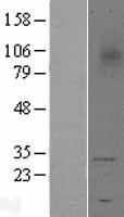 TREM1 Protein - Western validation with an anti-DDK antibody * L: Control HEK293 lysate R: Over-expression lysate