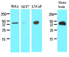 TREM2 / TREM-2 Antibody - Cell lysates of HeLa, MCF7, LNCaP and mouse brain (30 ug) were resolved by SDS-PAGE, transferred to NC membrane and probed with anti-human TREM2 (1:500). Proteins were visualized using a goat anti-mouse secondary antibody conjugated to HRP and an ECL detection system.