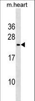 TREM2 / TREM-2 Antibody - Mouse Trem2 Antibody western blot of mouse heart tissue lysates (35 ug/lane). The Trem2 antibody detected the Trem2 protein (arrow).