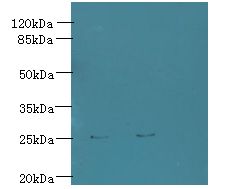 TREM2 / TREM-2 Antibody - Western blot. All lanes: Trem2 antibody at 6 ug/ml. Lane 1: Mouse liver tissue. Lane 2: Thp-1 whole cell lysate. Secondary Goat polyclonal to Rabbit IgG at 1:10000 dilution. Predicted band size: 25 kDa. Observed band size: 25 kDa.