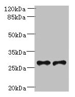 TREM2 / TREM-2 Antibody - Western blot All lanes: Trem2 antibody at 6µg/ml Lane 1: Mouse liver tissue Lane 2: THP-1 whole cell lysate Secondary Goat polyclonal to rabbit IgG at 1/10000 dilution Predicted band size: 25, 28 kDa Observed band size: 25 kDa