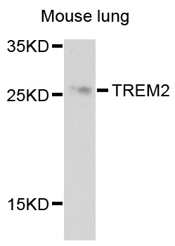 TREM2 / TREM-2 Antibody - Western blot analysis of extracts of mouse lung, using TREM2 antibody at 1:1000 dilution. The secondary antibody used was an HRP Goat Anti-Rabbit IgG (H+L) at 1:10000 dilution. Lysates were loaded 25ug per lane and 3% nonfat dry milk in TBST was used for blocking. An ECL Kit was used for detection and the exposure time was 20s.