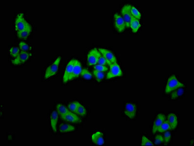 TREM2 / TREM-2 Antibody - Immunofluorescence staining of HepG2 cells with TREM2 Antibody at 1:166, counter-stained with DAPI. The cells were fixed in 4% formaldehyde, permeabilized using 0.2% Triton X-100 and blocked in 10% normal Goat Serum. The cells were then incubated with the antibody overnight at 4°C. The secondary antibody was Alexa Fluor 488-congugated AffiniPure Goat Anti-Rabbit IgG(H+L).