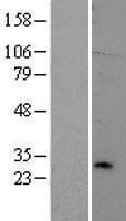 TREM2 / TREM-2 Protein - Western validation with an anti-DDK antibody * L: Control HEK293 lysate R: Over-expression lysate