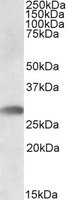 TREML1 / TLT1 Antibody - TREML1 antibody staining (0.5 ug/ml) of Human Bone Marrow lysate (RIPA buffer, 35g total protein per lane). Primary incubated for 1 hour. Detected by Western blot of chemiluminescence.
