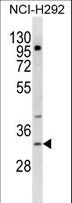 TREML1 / TLT1 Antibody - TREML1 Antibody western blot of NCI-H292 cell line lysates (35 ug/lane). The TREML1 antibody detected the TREML1 protein (arrow).