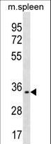 TREML1 / TLT1 Antibody - TREML1 Antibody western blot of mouse spleen tissue lysates (35 ug/lane). The TREML1 antibody detected the TREML1 protein (arrow).