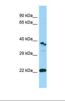TREML1 / TLT1 Antibody - Western blot of Human MCF7. TREML1 antibody dilution 1.0 ug/ml.  This image was taken for the unconjugated form of this product. Other forms have not been tested.