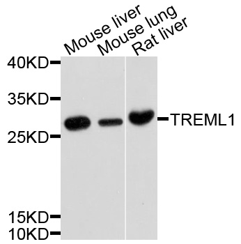 TREML1 / TLT1 Antibody - Western blot analysis of extracts of various cell lines, using TREML1 antibody at 1:1000 dilution. The secondary antibody used was an HRP Goat Anti-Rabbit IgG (H+L) at 1:10000 dilution. Lysates were loaded 25ug per lane and 3% nonfat dry milk in TBST was used for blocking. An ECL Kit was used for detection and the exposure time was 10s.