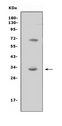 TREML1 / TLT1 Antibody - Western blot analysis of TREML1 using anti-TREML1 antibody. Electrophoresis was performed on a 5-20% SDS-PAGE gel at 70V (Stacking gel) / 90V (Resolving gel) for 2-3 hours. The sample well of each lane was loaded with 50ug of sample under reducing conditions. Lane 1: human THP-1 whole cell lysates. After Electrophoresis, proteins were transferred to a Nitrocellulose membrane at 150mA for 50-90 minutes. Blocked the membrane with 5% Non-fat Milk/ TBS for 1.5 hour at RT. The membrane was incubated with rabbit anti-TREML1 antigen affinity purified polyclonal antibody at 0.5 µg/mL overnight at 4°C, then washed with TBS-0.1% Tween 3 times with 5 minutes each and probed with a goat anti-rabbit IgG-HRP secondary antibody at a dilution of 1:10000 for 1.5 hour at RT. The signal is developed using an Enhanced Chemiluminescent detection (ECL) kit with Tanon 5200 system. A specific band was detected for TREML1 at approximately 33KD. The expected band size for TREML1 is at 33KD.
