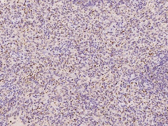 TREML1 / TLT1 Antibody - Immunochemical staining of human TREML1 in human spleen with rabbit polyclonal antibody at 1:100 dilution, formalin-fixed paraffin embedded sections.