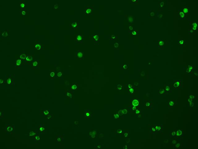 TREML1 / TLT1 Antibody - Immunofluorescence staining of TREML1 in jurkat cells. Cells were fixed with 4% PFA, blocked with 10% serum, and incubated with rabbit anti-Human TREML1 polyclonal antibody (dilution ratio 1:100) at 4°C overnight. Then cells were stained with the Alexa Fluor 488-conjugated Goat Anti-rabbit IgG secondary antibody (green). Positive staining was localized to Cytoplasm and cell membrane.