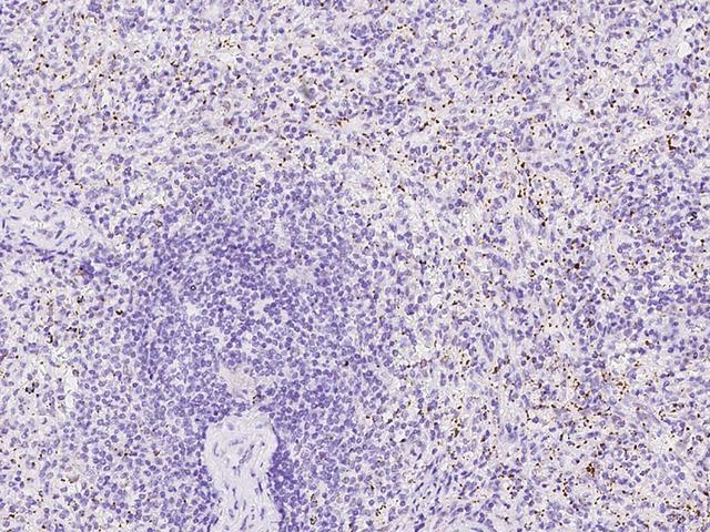 TREML1 / TLT1 Antibody - Immunochemical staining of human TREML1 in human spleen with rabbit polyclonal antibody at 1:300 dilution, formalin-fixed paraffin embedded sections.