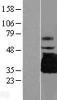 TREML1 / TLT1 Protein - Western validation with an anti-DDK antibody * L: Control HEK293 lysate R: Over-expression lysate