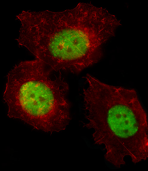 TRERF1 Antibody - Fluorescent image of MCF-7 cell stained with TREF1 Antibody. MCF-7 cells were fixed with 4% PFA (20 min), permeabilized with Triton X-100 (0.1%, 10 min), then incubated with TREF1 primary antibody (1:25, 1 h at 37°C). For secondary antibody, Alexa Fluor 488 conjugated donkey anti-rabbit antibody (green) was used (1:400, 50 min at 37°C). Cytoplasmic actin was counterstained with Alexa Fluor 555 (red) conjugated Phalloidin (7units/ml, 1 h at 37°C). TREF1 immunoreactivity is localized to Nucleus significantly.