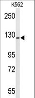TRERF1 Antibody - Western blot of TREF1 Antibody in K562 cell line lysates (35 ug/lane). TREF1 (arrow) was detected using the purified antibody.