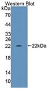 TRERF1 Antibody - Western blot of TRERF1 antibody.