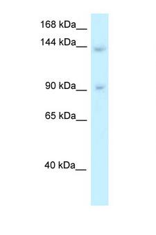 TRERF1 Antibody - TRERF1 antibody Western blot of 721_B Cell lysate. Antibody concentration 1 ug/ml.  This image was taken for the unconjugated form of this product. Other forms have not been tested.