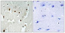 TRERF1 Antibody - Peptide - + Immunohistochemistry analysis of paraffin-embedded human brain tissue, using TREF1 antibody.