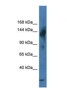 TRERF1 Antibody - TRERF1 antibody Western blot of Mouse Intestine lysate. Antibody concentration 1 ug/ml.  This image was taken for the unconjugated form of this product. Other forms have not been tested.