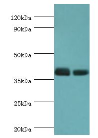 TREX1 Antibody - Western blot. All lanes: Three-prime repair exonuclease 1 antibody at 3 ug/ml. Lane 1: HeLa whole cell lysate. Lane 2: HepG2 whole cell lysate. Secondary antibody: Goat polyclonal to rabbit at 1:10000 dilution. Predicted band size: 39 kDa. Observed band size: 39 kDa.
