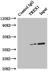 TREX1 Antibody - Immunoprecipitating TREX1 in Hela whole cell lysate Lane 1: Rabbit monoclonal IgG (1µg) instead of TREX1 Antibody in Hela whole cell lysate.For western blotting, a HRP-conjugated anti-rabbit IgG, specific to the non-reduced form of IgG was used as the Secondary antibody (1/50000) Lane 2: TREX1 Antibody (4µg) + Hela whole cell lysate (500µg) Lane 3: Hela whole cell lysate (20µg)