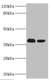TREX1 Antibody - Western blot All lanes: Three-prime repair exonuclease 1 antibody at 3µg/ml Lane 1: Hela whole cell lysate Lane 2: HepG2 whole cell lysate Secondary Goat polyclonal to rabbit IgG at 1/10000 dilution Predicted band size: 39, 33, 34 kDa Observed band size: 39 kDa