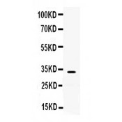 TREX1 Antibody - TREX1 antibody Western blot. All lanes: Anti TREX1 at 0.5 ug/ml. WB: SMMC Whole Cell Lysate at 40 ug. Predicted band size: 33 kD. Observed band size: 33 kD.