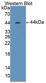 TREX1 Antibody - Western blot of TREX1 antibody.