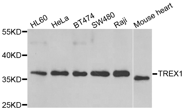 TREX1 Antibody - Western blot analysis of extracts of various cell lines.